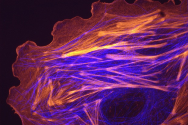 Fluorescence microscopy is widely used to image and observe the cytoskeleton, which consists of various proteins that form filamentous structures in the cell.  In this mammalian cell, actin filaments that form a mesh around the edges of the cell are stained red, and the microtubules that are centrally bundled are stained blue.